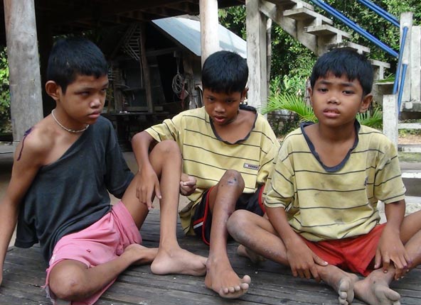 កូនៗដែលពិការ