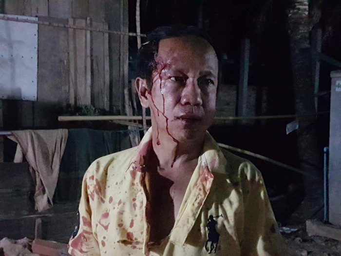 ជនរងគ្រោះ